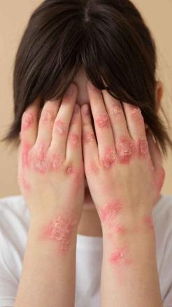 These 6 Health Problems Can Occur Due to Lack of Sunlight in...