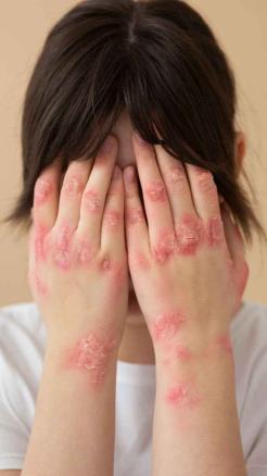 5 Amazing Benefits of Bathing with Neem Leaves