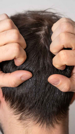 Home Remedies to Control Hair Fall Naturally at Home