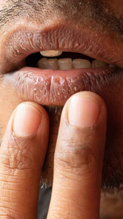 Six Hidden Signs Your Body Is Secretly Dehydrated