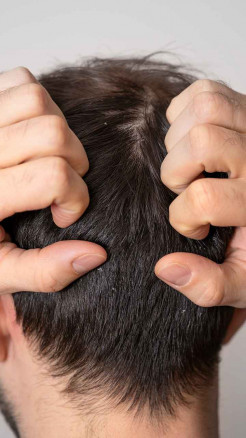 सर्दियों में आँवला क्यों जरूरी? जानिए 6 मुख्य लाभ