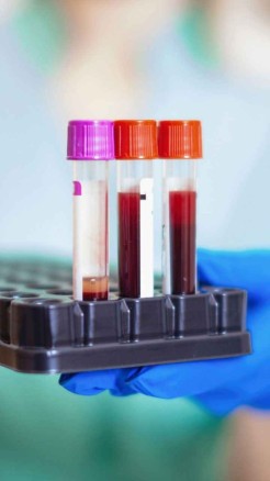 Reap Amazing Benefits by Eating Soaked Chickpeas Every Morni...